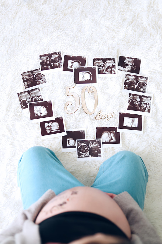 広島県での撮影が可能なカメラマン「Shiori」の作例画像